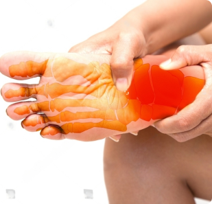 Peripheral Neuropathy